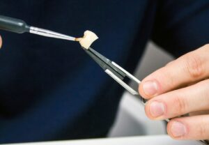 dental crowns