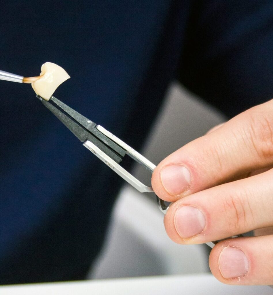 dental crowns
