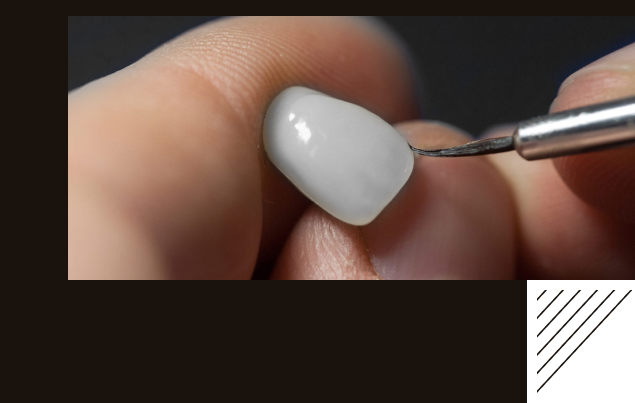 A close-up photograph of a gloved hand holding a single porcelain veneer while a small brush applies a stain or glaze to its surface.
