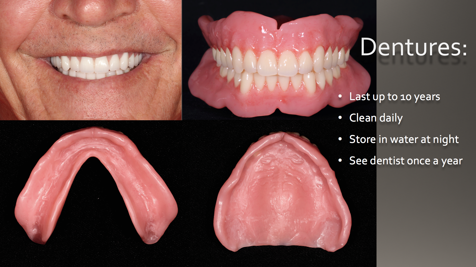 A man smiling with complete upper and lower dentures, alongside a close-up photo of the full set, a view of the upper palate base, and the lower arch base. The image includes bullet points with denture care instructions: last up to 10 years, clean daily, store in water at night, see dentist once a year.