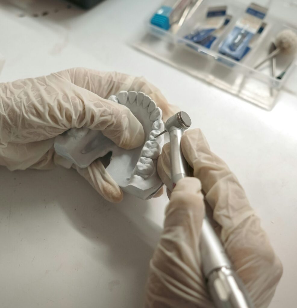 A close-up shot of Dr. Murphy's gloved hands using a precision dental tool to hand-finish a detailed, cream-colored 3D-printed dental model, representing a custom restorative plan for a patient with multiple missing teeth (hypodontia). A tray of dental tools is in the background.